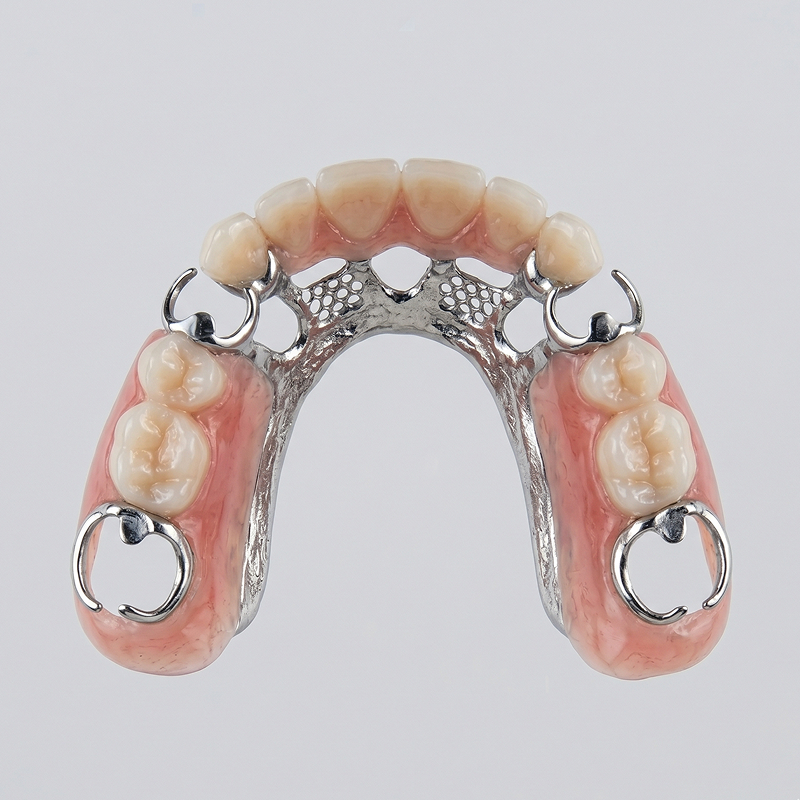 Partial Dentures